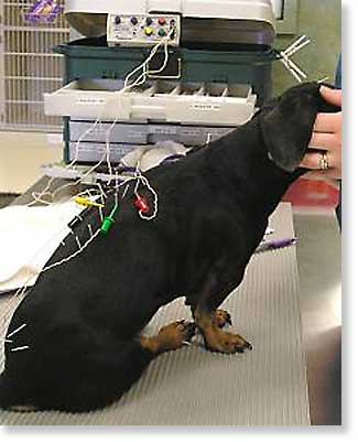 Acupuncture